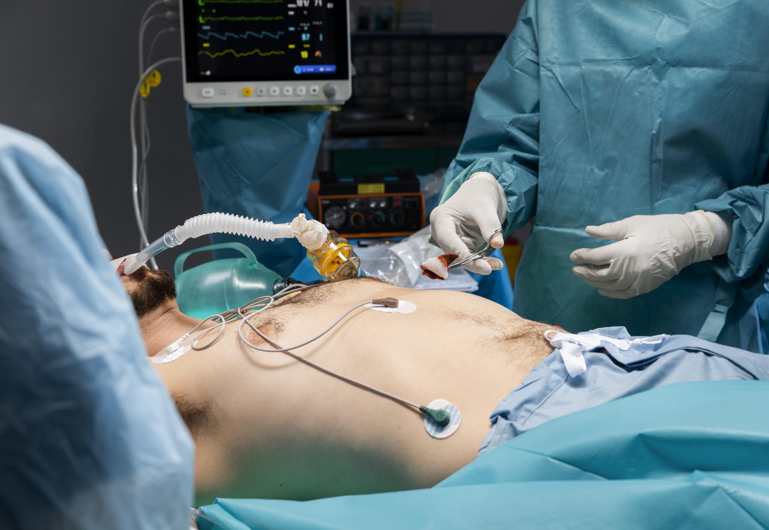 How Laparoscopic Pancreatectomy Treats Pancreatic Problems